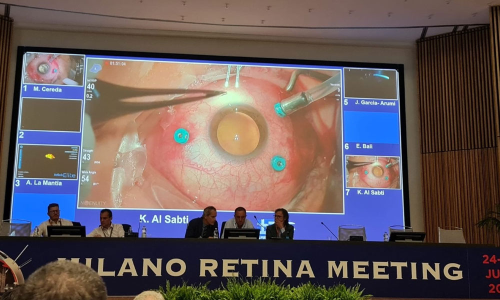 Kuwait ophthalmologist shows innovative techniques at Milan conf.