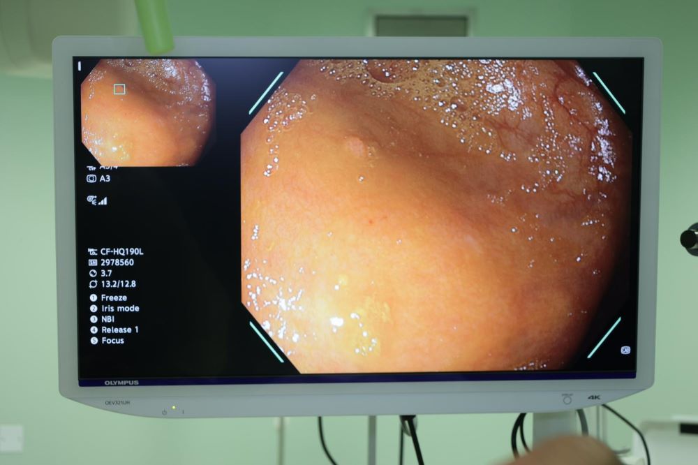 Jaber Hospital doctors perform Kuwait's first colonoscopy using artificial intelligence